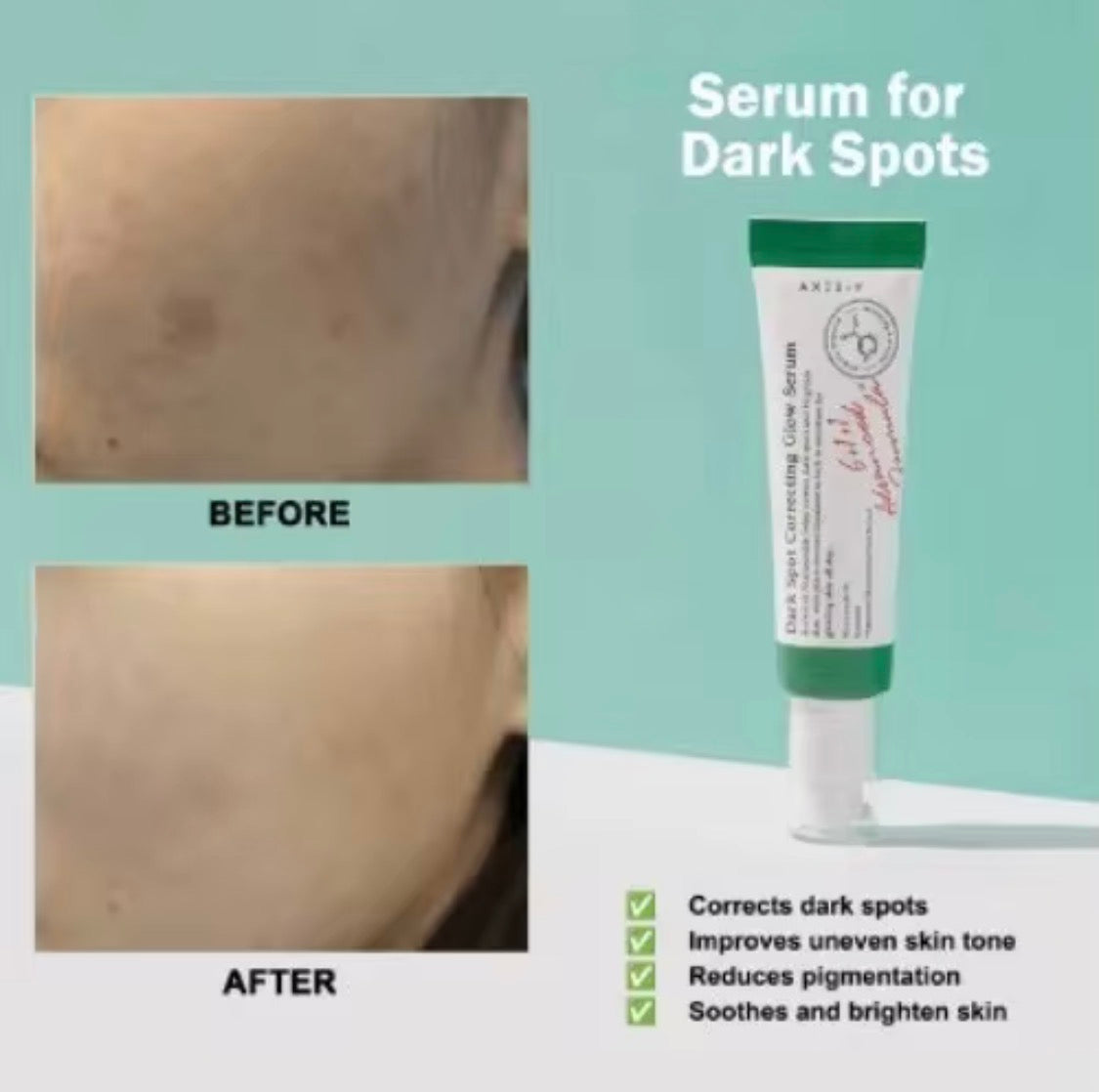 AXIS- Y Dark Spot Hyperpigmentation Cream made with Niacinamide and Papaya extract