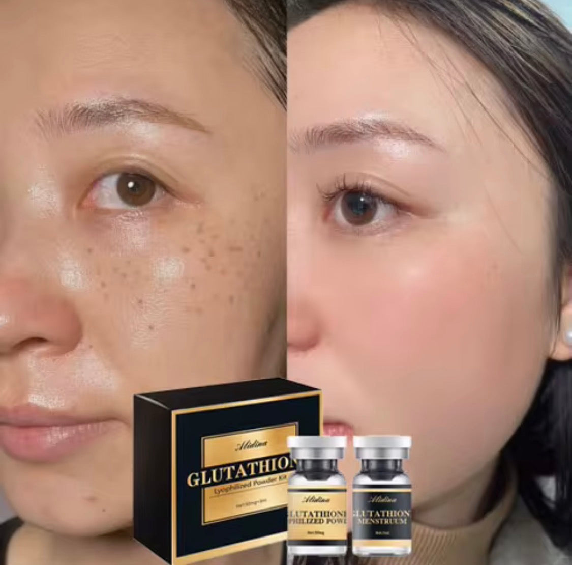 Glutathione Lyophilized Powder Glow Serum Kit