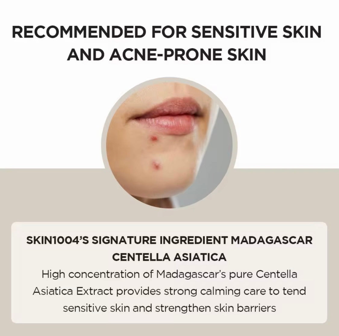 SKIN1004 Madagascar Centella Asiatica Ampoule Serum