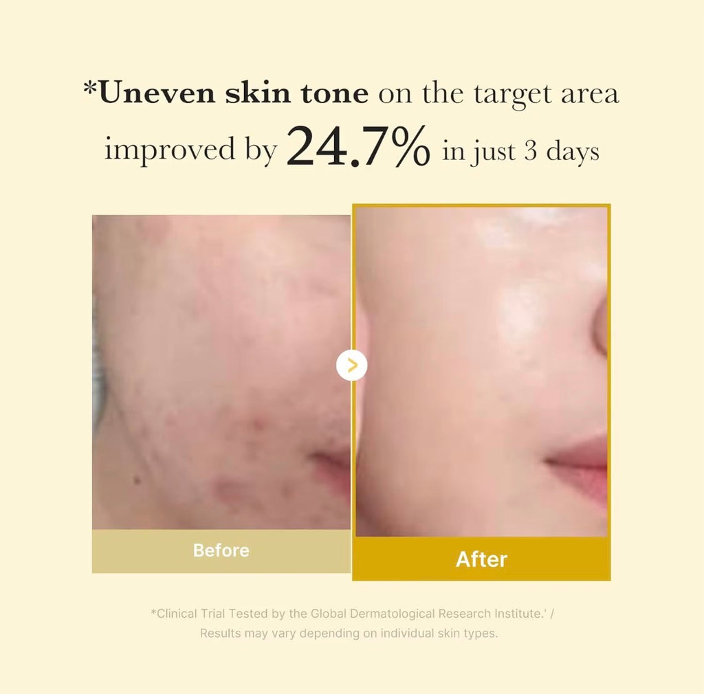 Medicube Kojic Acid Turmeric Overnight Peel-Off Mask – Brightening & Glow Care
