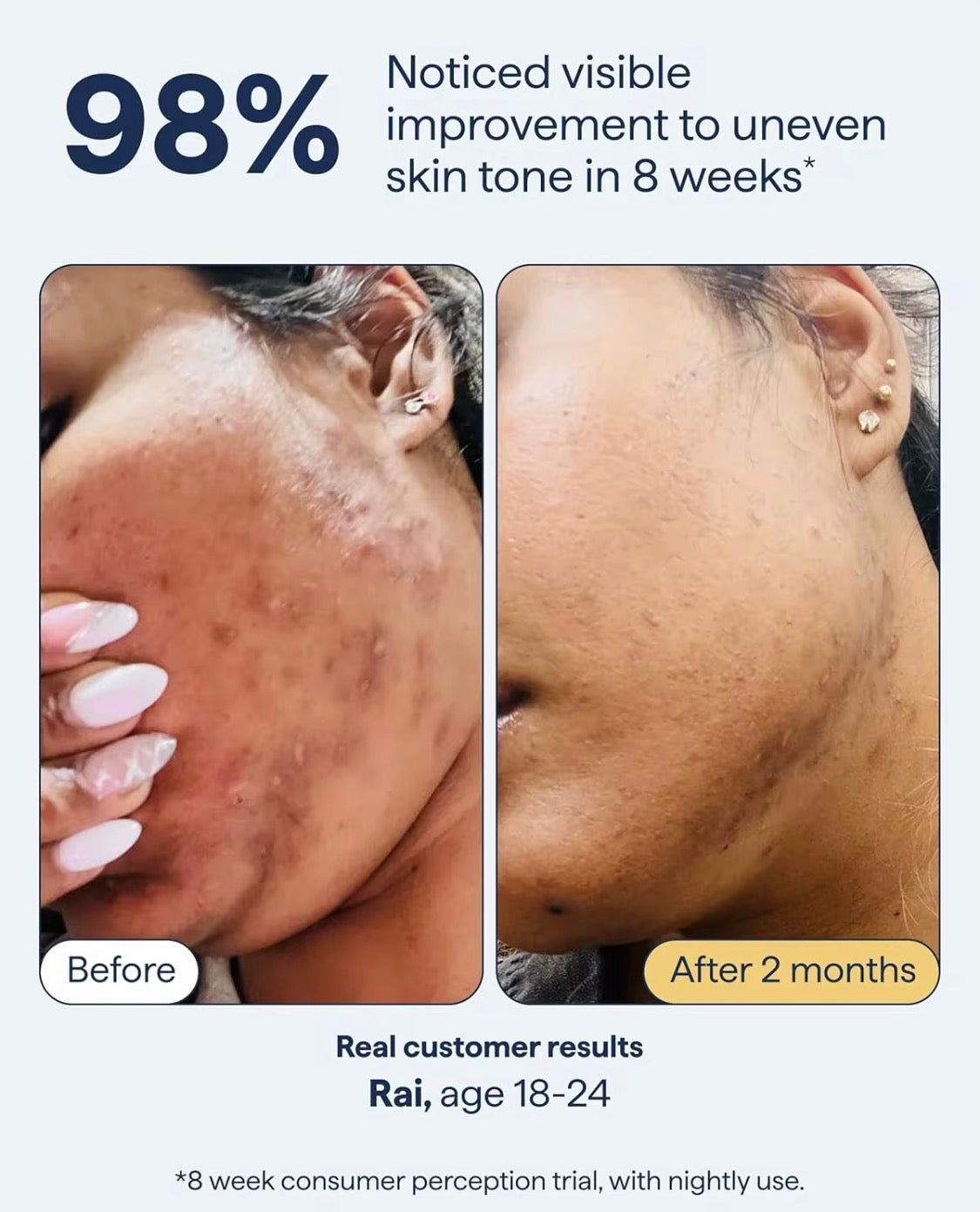 SEYE Dark Spot & Discolouration Remedy