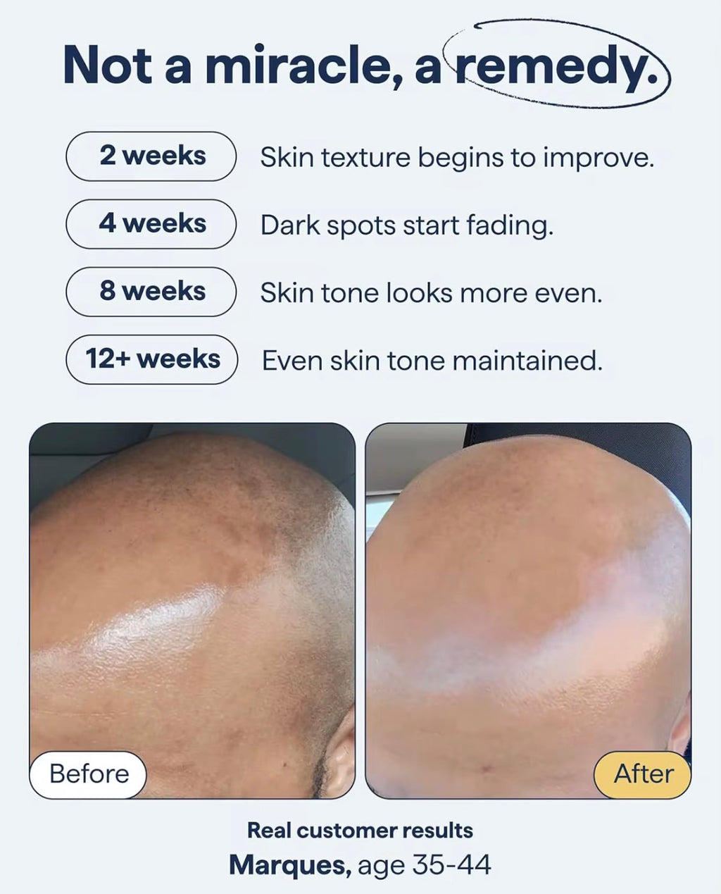 SEYE Dark Spot & Discolouration Remedy
