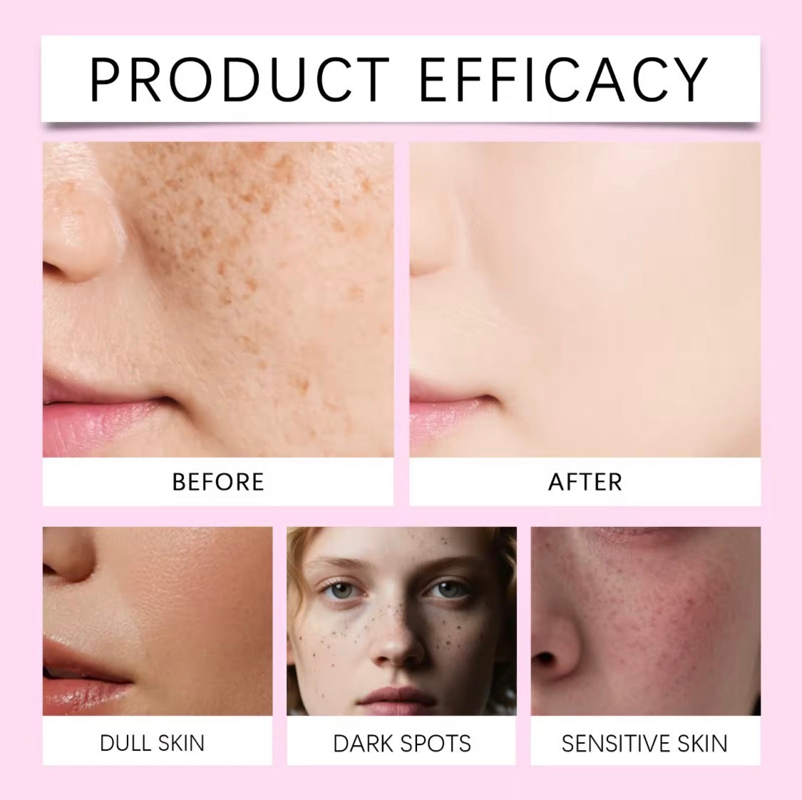 Arbutin 7% + TXA 4% Tranexamic Acid