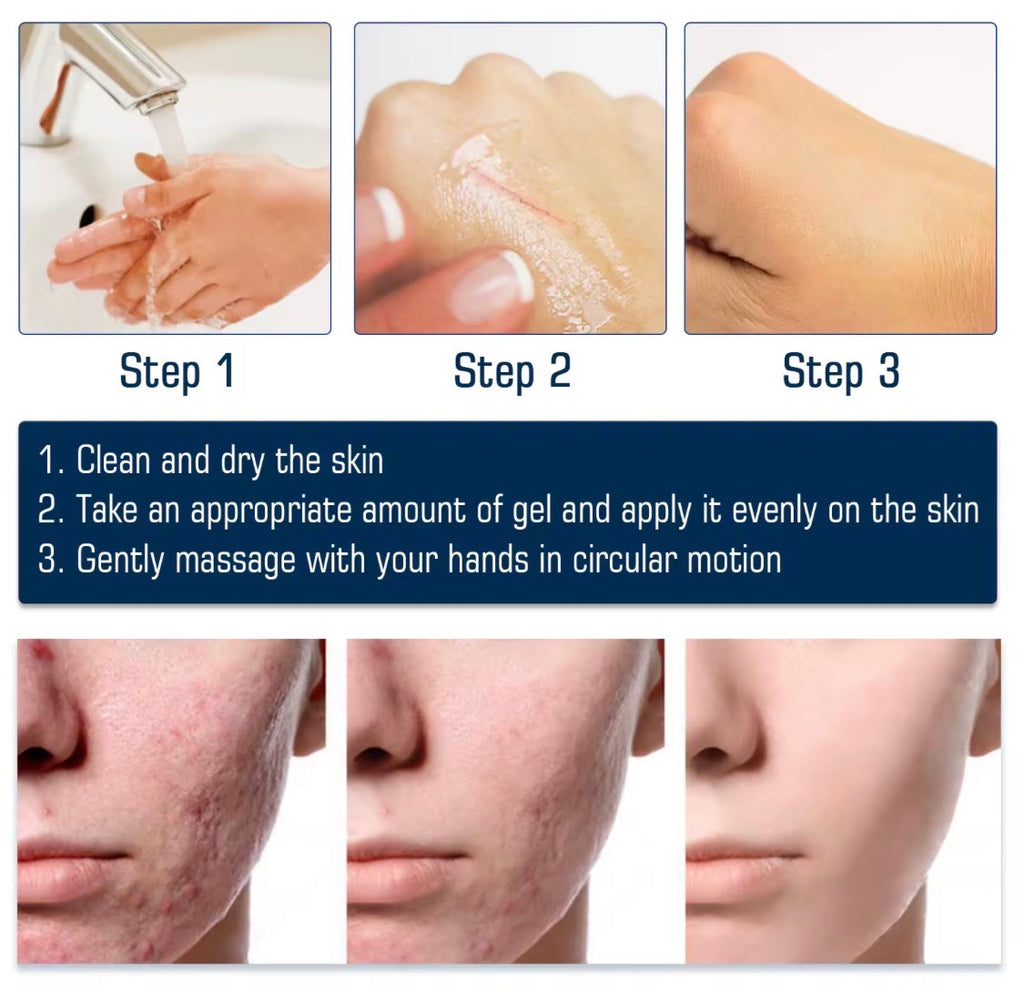 Scar removal gel