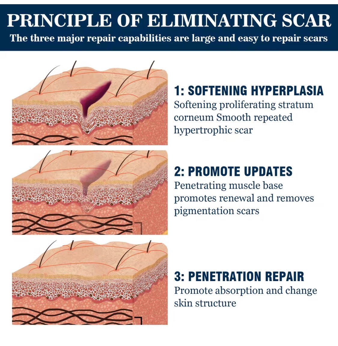 Scar removal gel