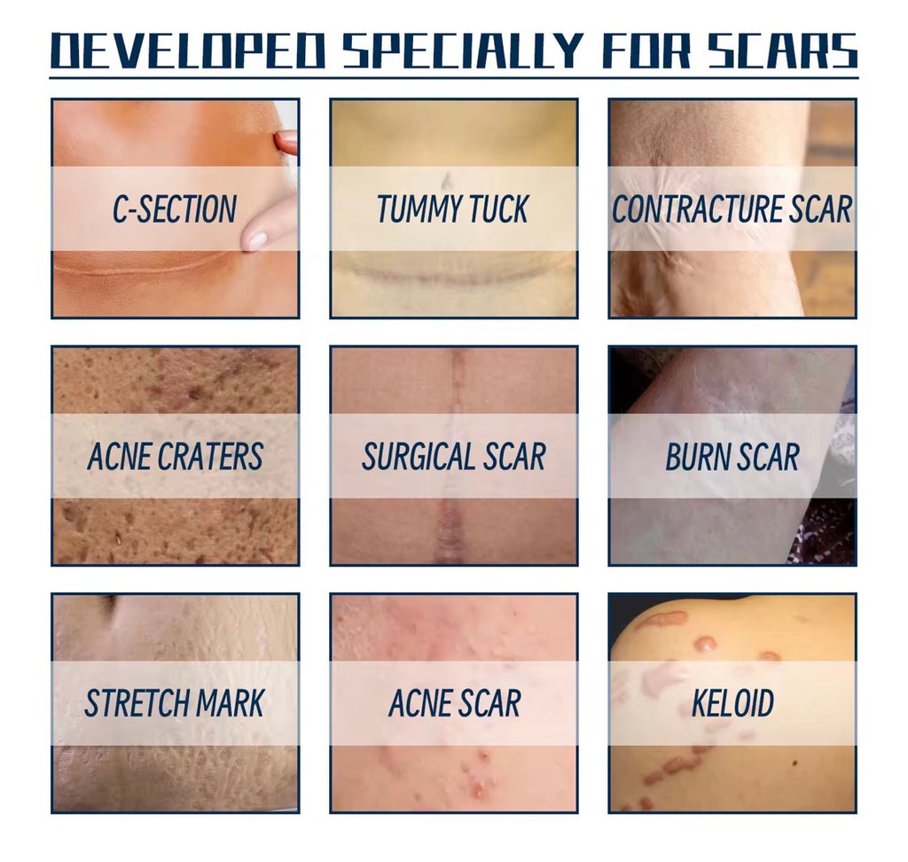 Scar removal gel
