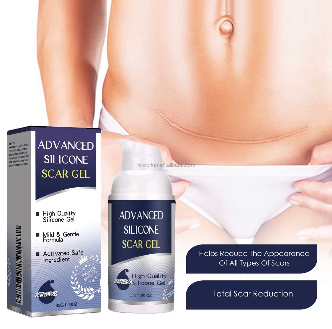 Medical-Grade Silicone Scar Gel for Keloids & Stretch Marks